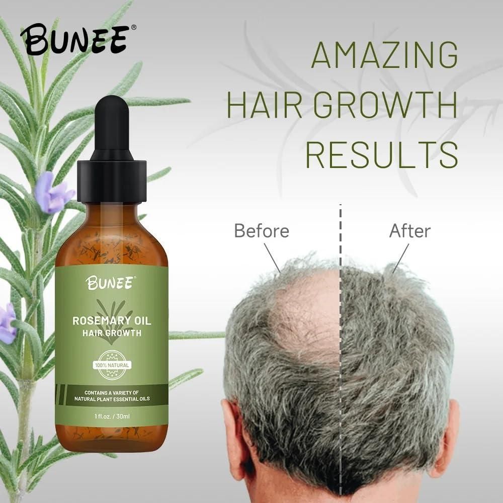 BUNEE Rosemary Hair Growth_noQ2