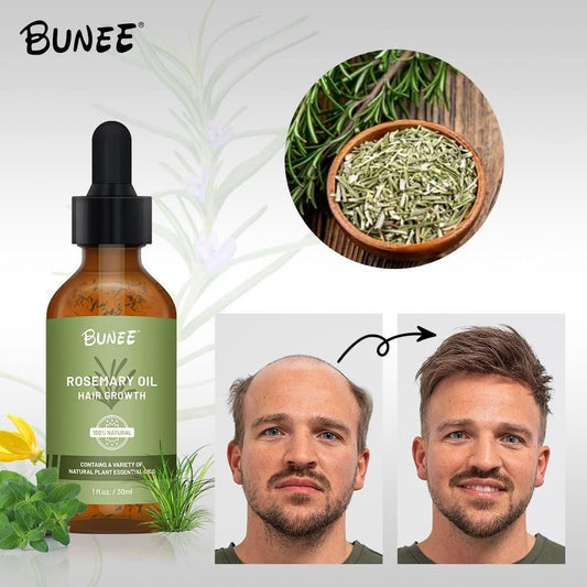 BUNEE Rosemary Hair Growth_noQ